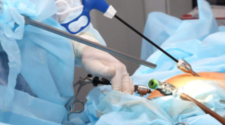 Ovarian Cyst Removal Surgery