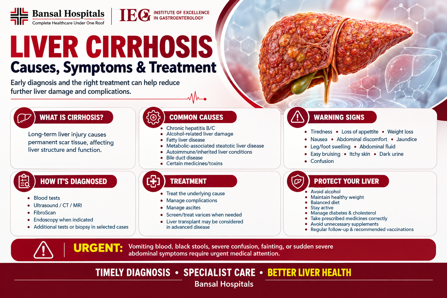 Best Doctor for Liver Cirrhosis Treatment in Delhi